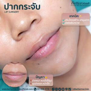 รีวิว ปากกระจับ better me