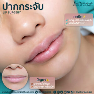 รีวิว ปากกระจับ better me