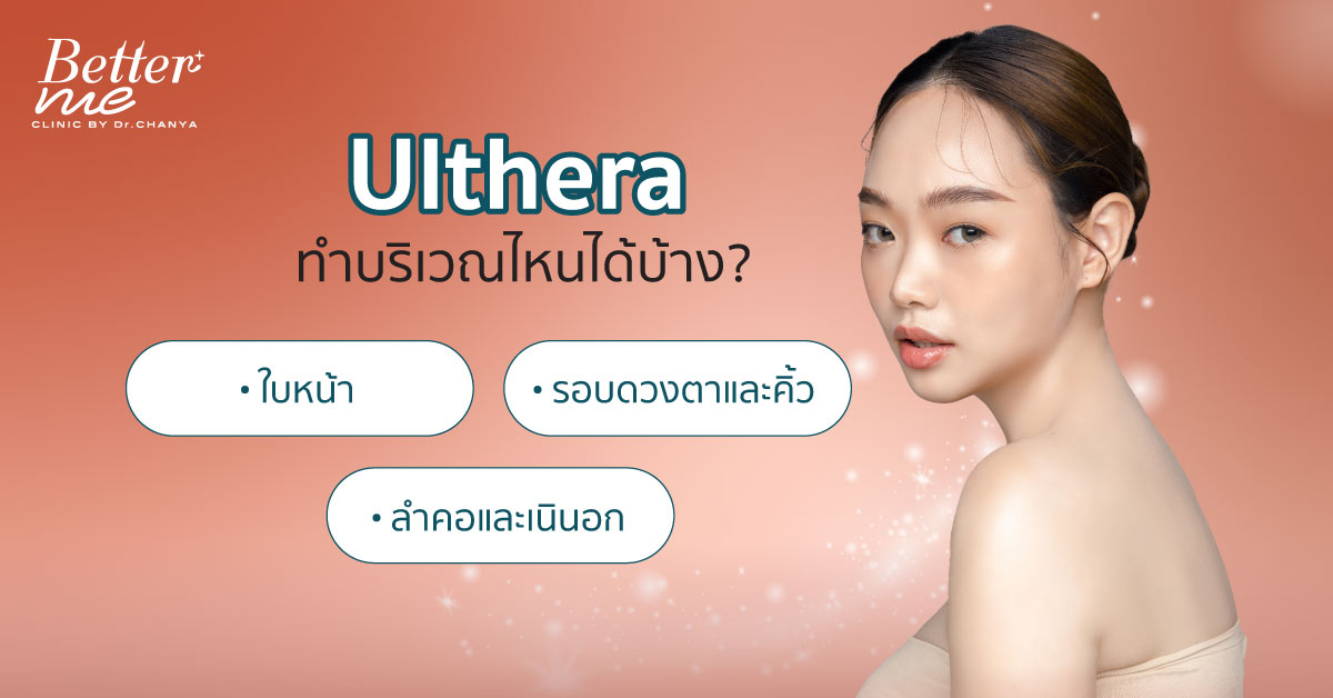 Ulthera ทำบริเวณไหนได้บ้าง?