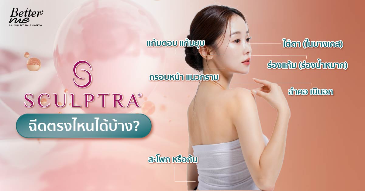 Sculptra ฉีดตรงไหนได้บ้าง?