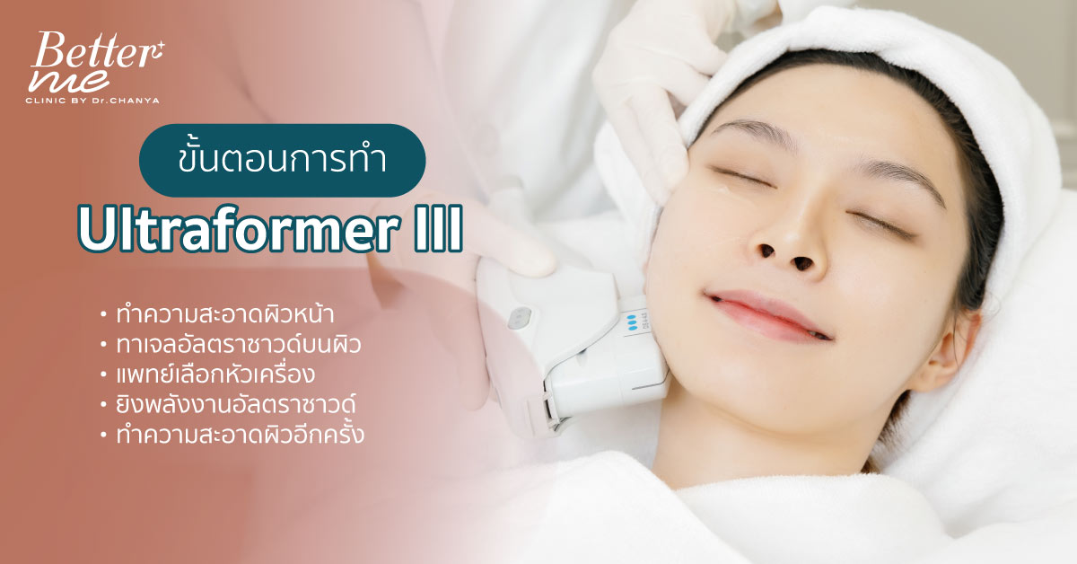 ขั้นตอนการทำ Ultraformer III