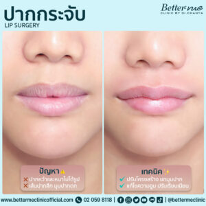 รีวิวประจับ