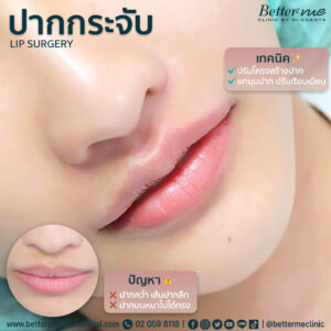 รีวิวปากกระจับ