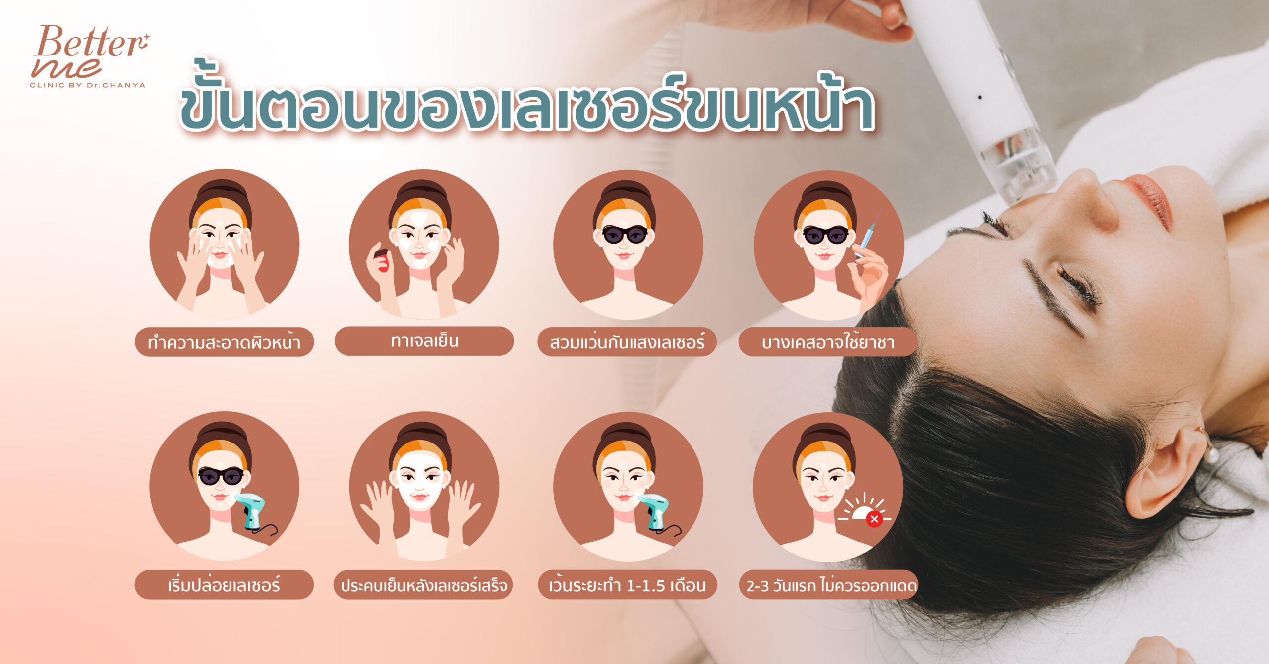 ขั้นตอนของเลเซอร์ขนหน้า