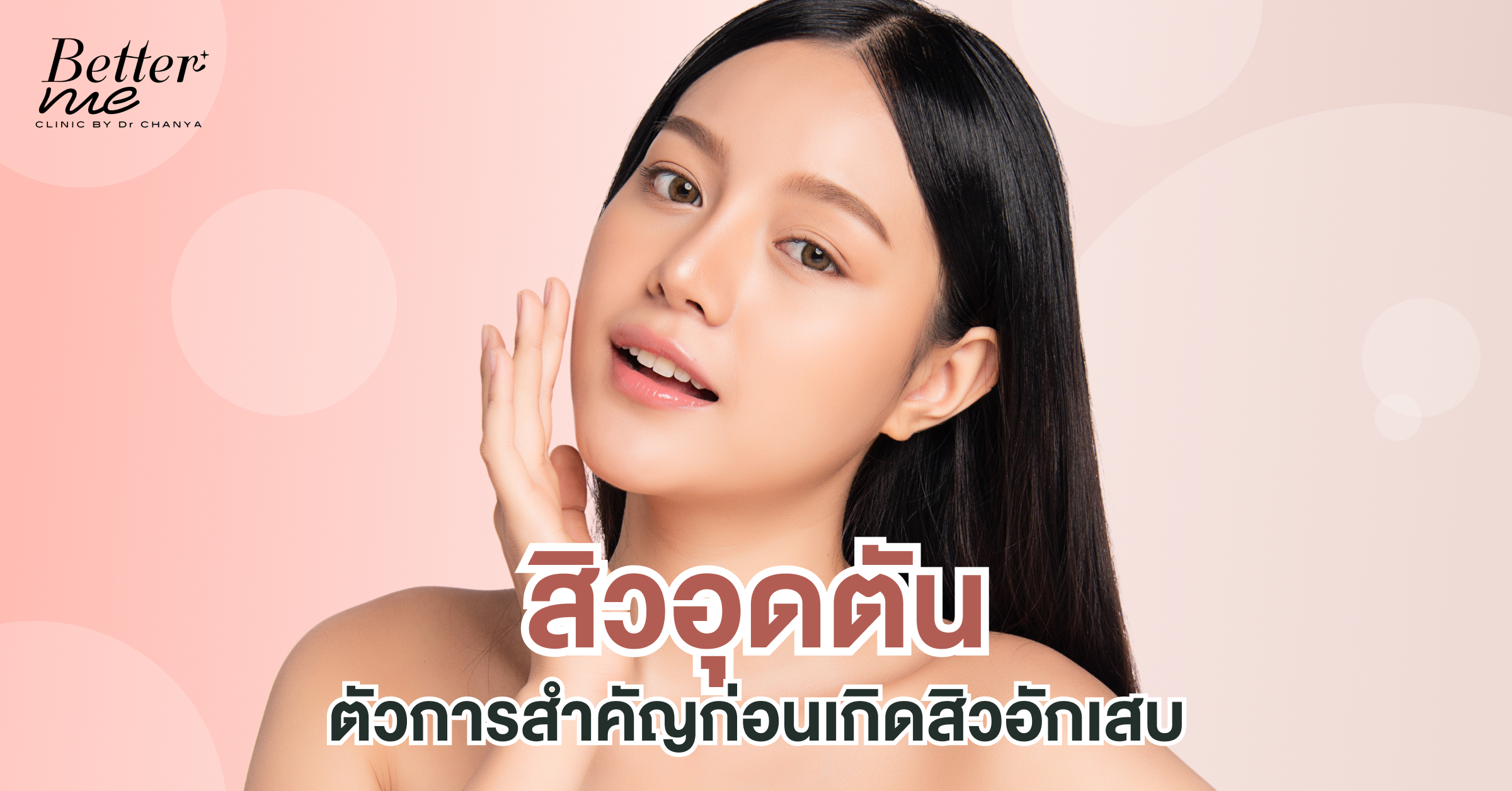 สิวอุดตัน ตัวการสำคัญก่อนเกิดสิวอักเสบ