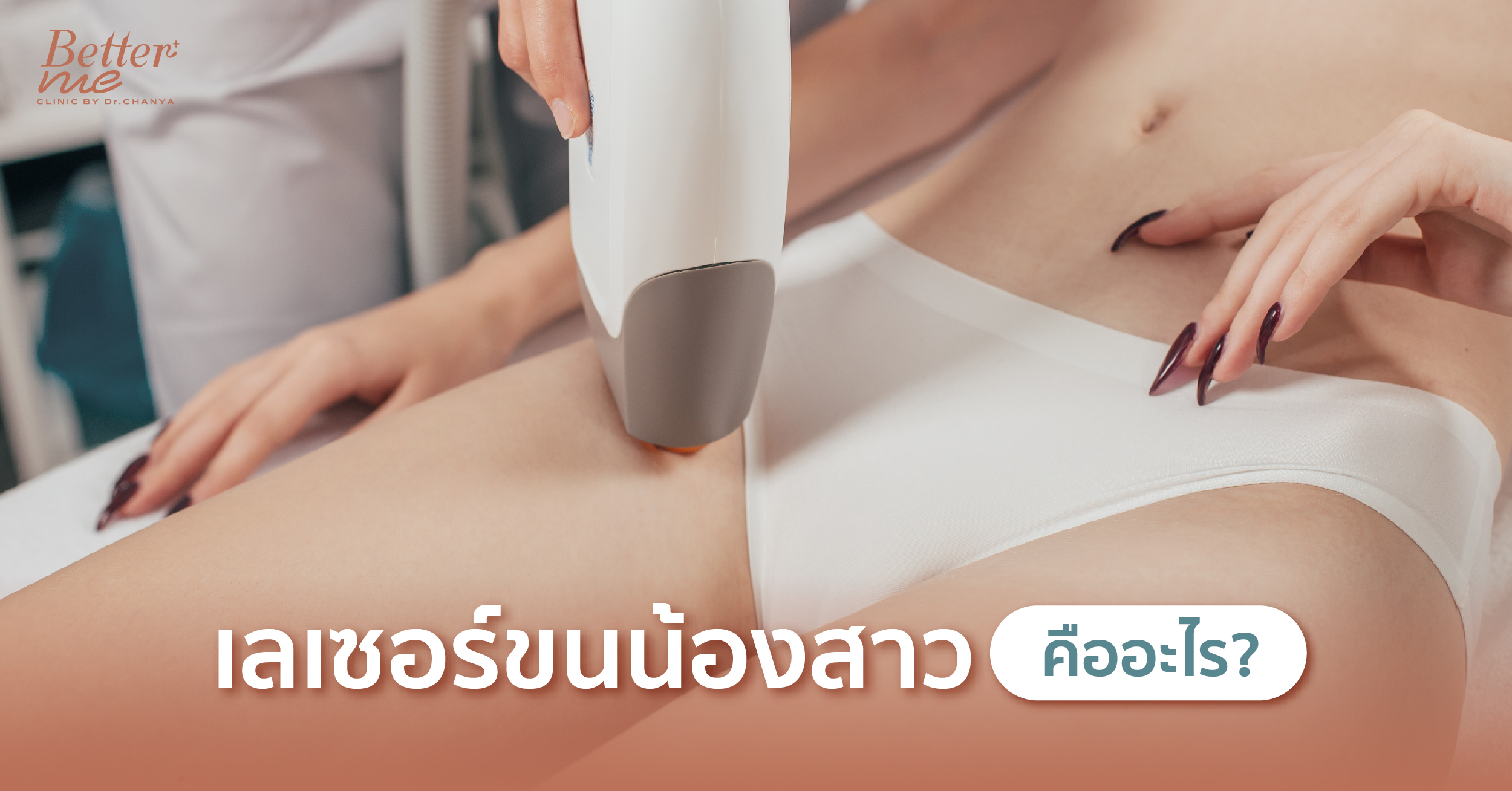 เลเซอร์ขนน้องสาวคืออะไร?