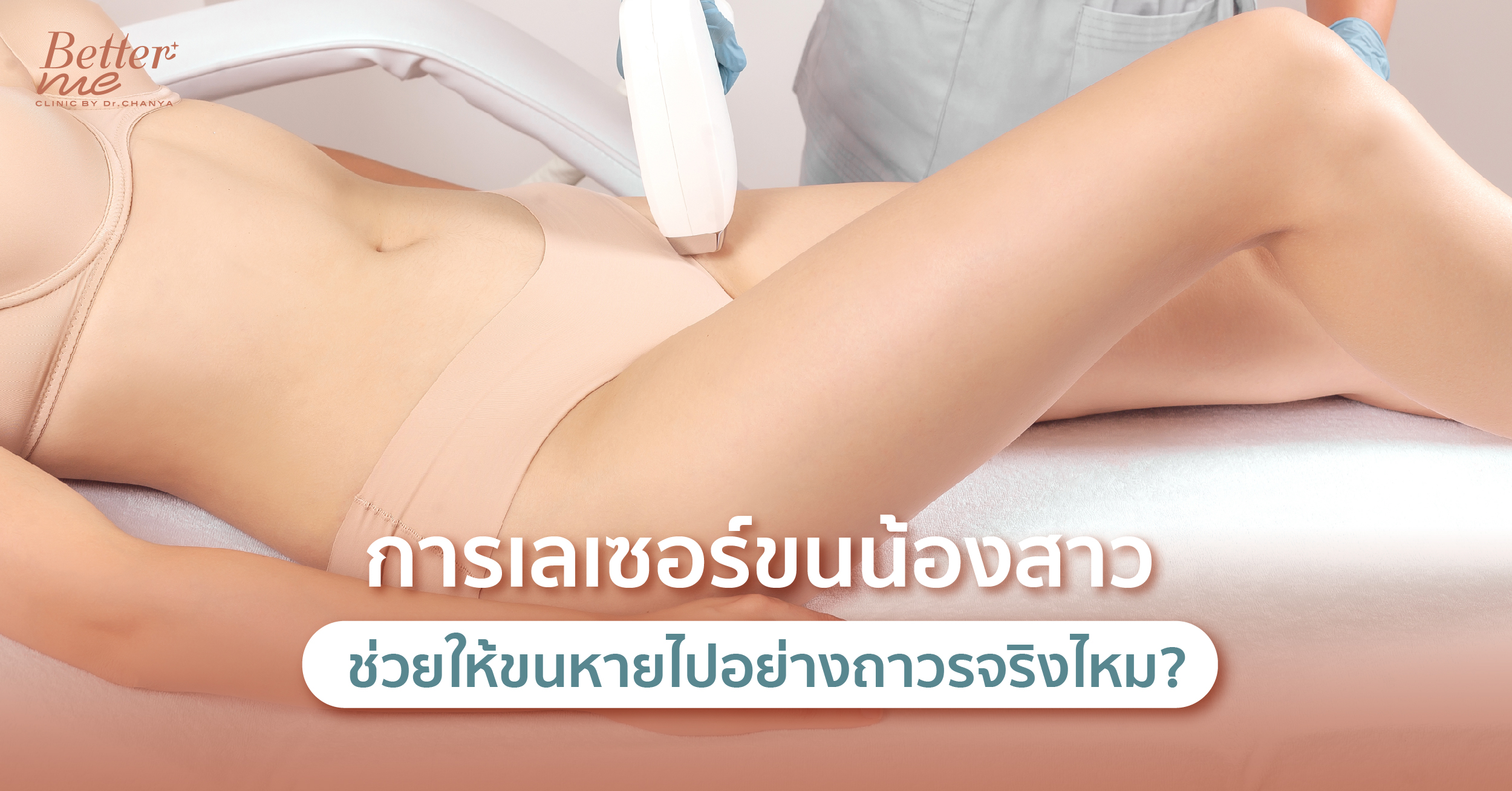 การเลเซอร์ขนน้องสาวช่วยให้ขนหายไปอย่างถาวรจริงไหม?