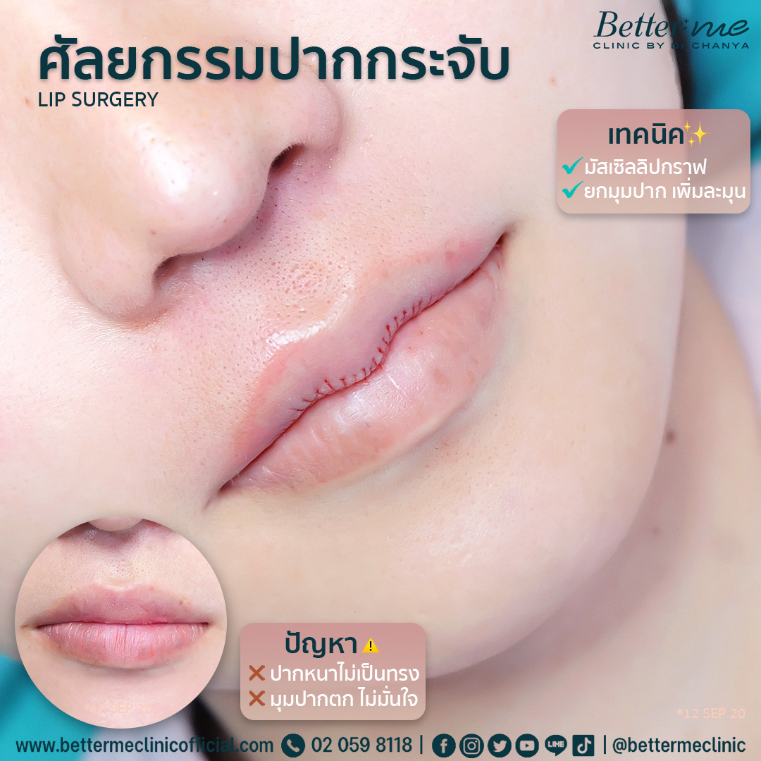 ศัลยกรรมปาก