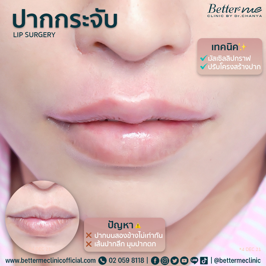 ศัลยกรรมปาก