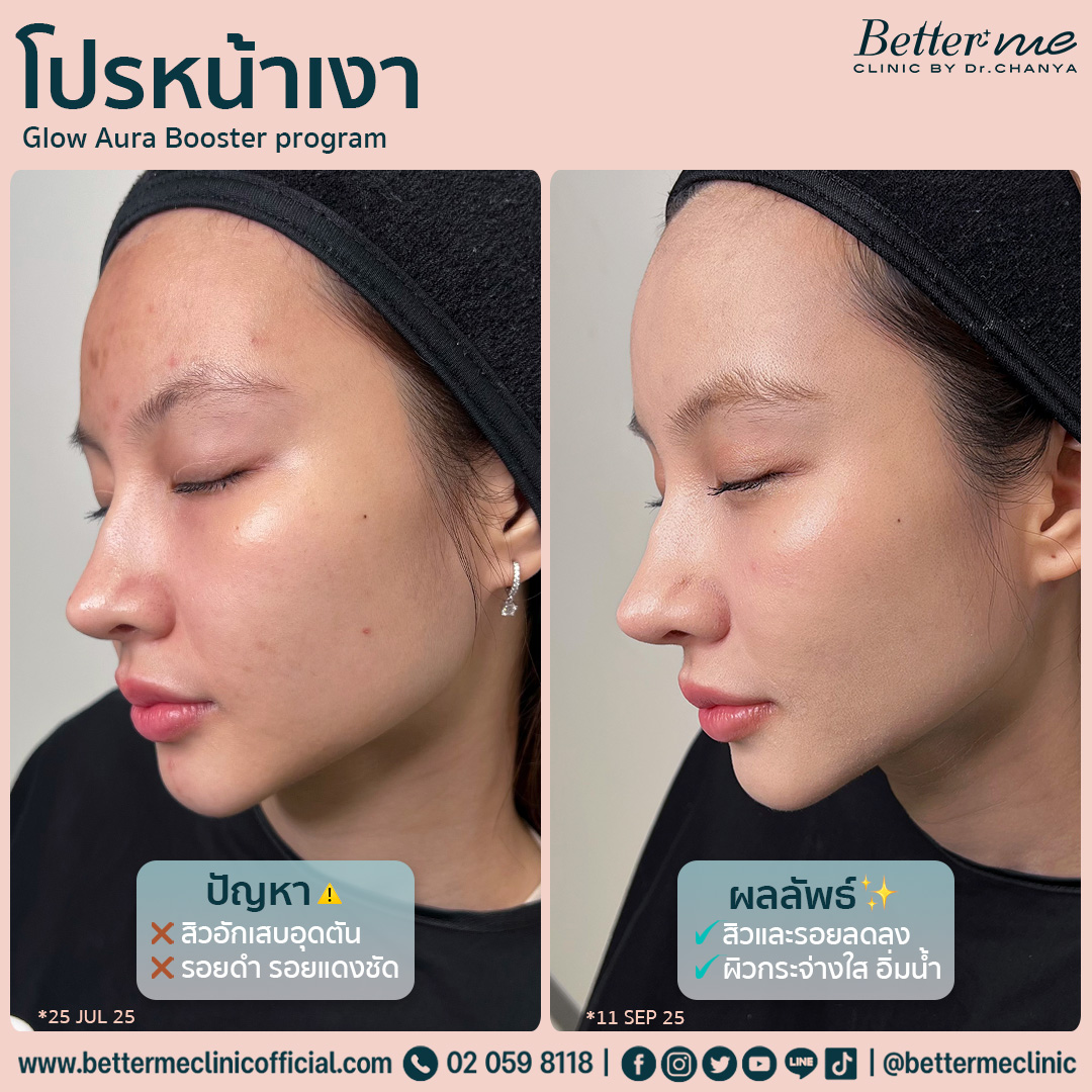 โปรหน้าเงา