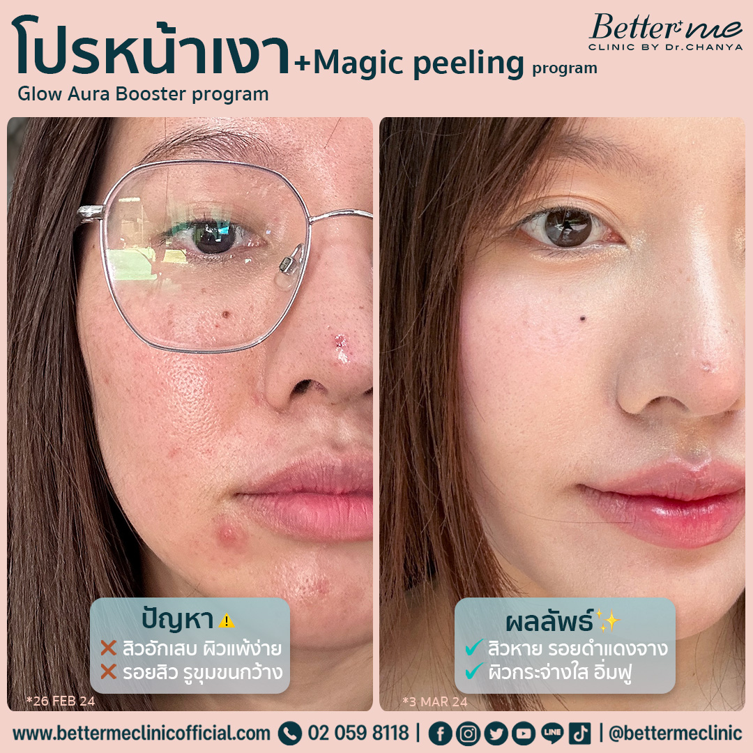 โปรหน้าเงา