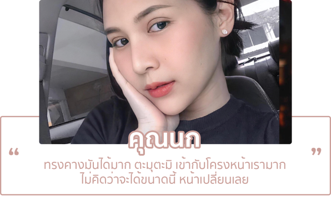 เสริมคาง3