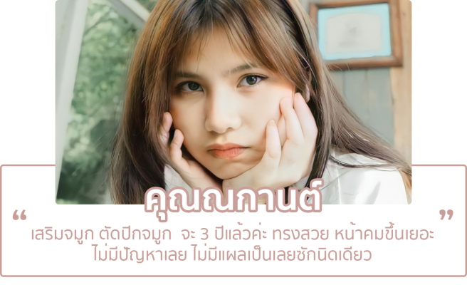 3feedbackคนไข้หมอเกียร์ เสริมจมูกตัดปีกจมูก 3ปี ประทับใจ testimonial